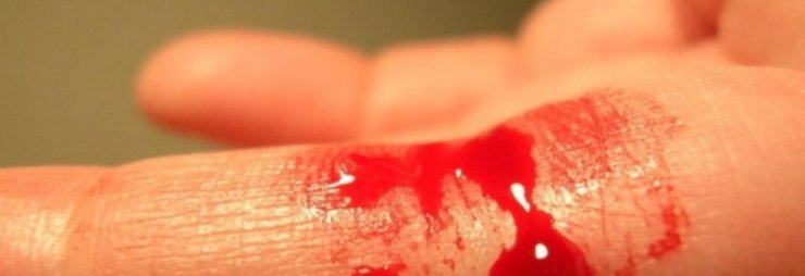 Лопнул геморрой – что делать и как остановить кровотечение