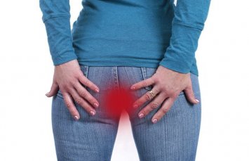 Почему возникает зуд в заднем проходе у женщин: причины и лечение