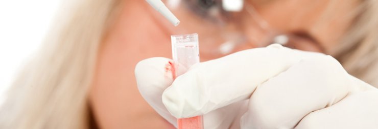 Можно ли определить рак по анализу крови – правда или ложь?