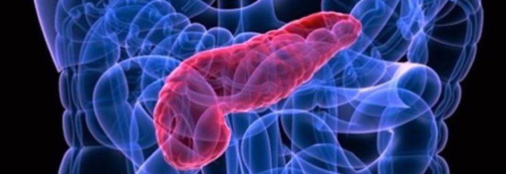 Прогноз продолжительности жизни при хроническом панкреатите поджелудочной железы – сколько можно прожить при этом заболевании